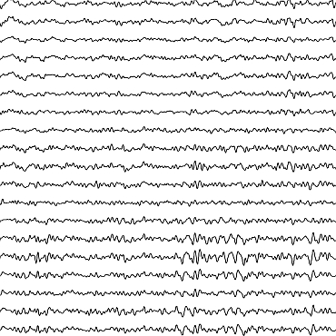 Brainwaves in 19-point EEG recording
