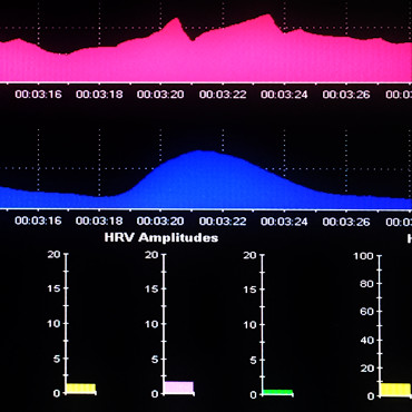 HRV or heart rate variability screen showing heart rate in pink with jagged peaks and smooth breathing in blue. Low HRV