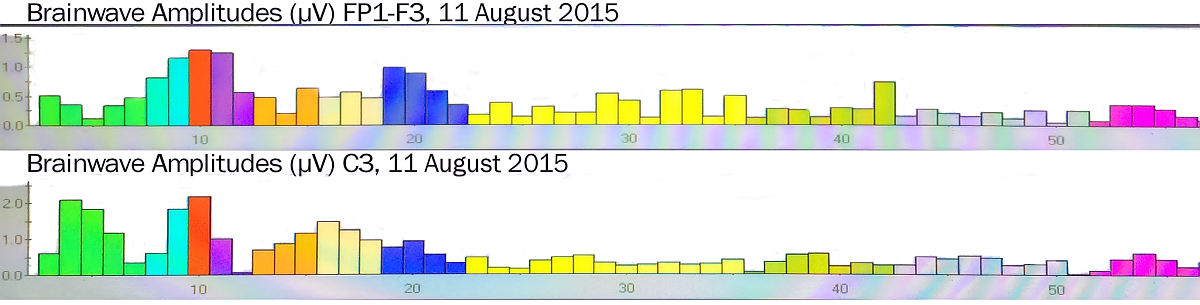Brainwave Amplitude bars FP1-F3 and C3 mine Aug 2015
