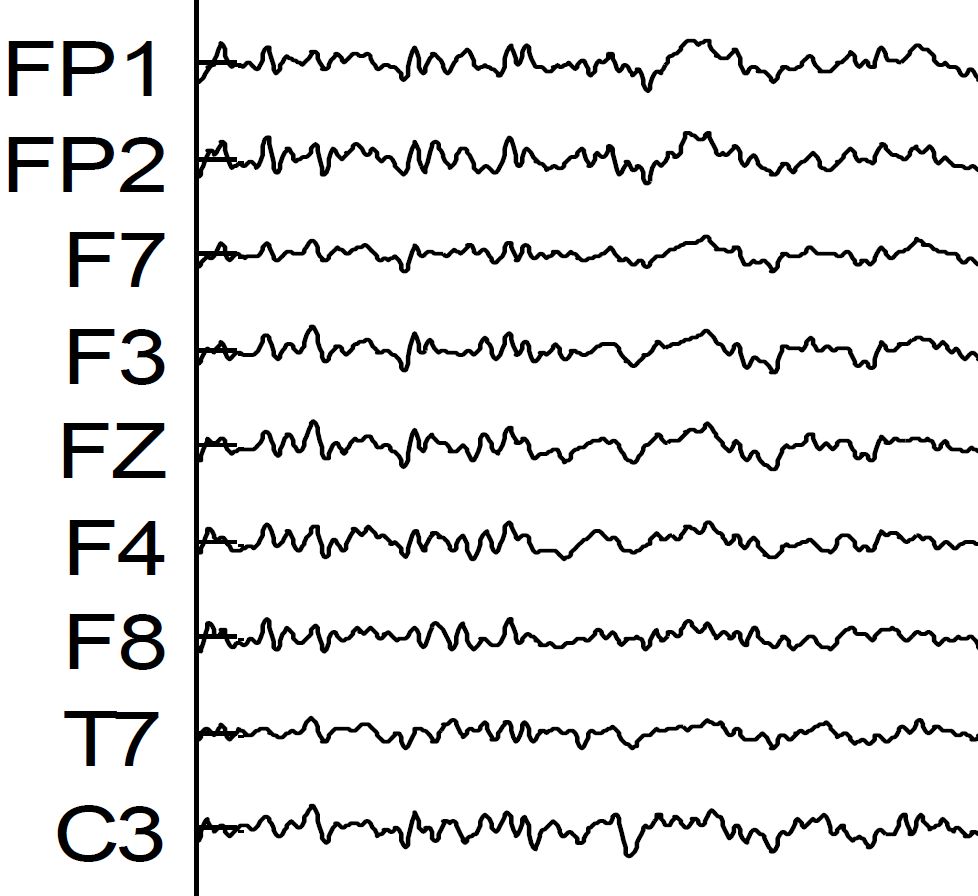 EEG of my delta brainwaves