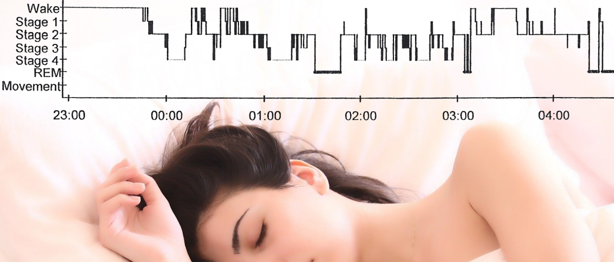 Sleeping woman with brunette hair and peaceful face on a cream-coloured pillow with a graph of sleep stages across the top showing bad sleep.
