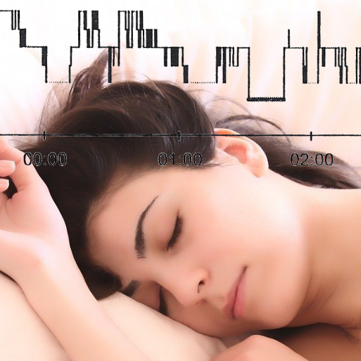 Sleeping woman with brunette hair and peaceful face on a cream-coloured pillow with a graph of sleep stages across the top showing bad sleep.