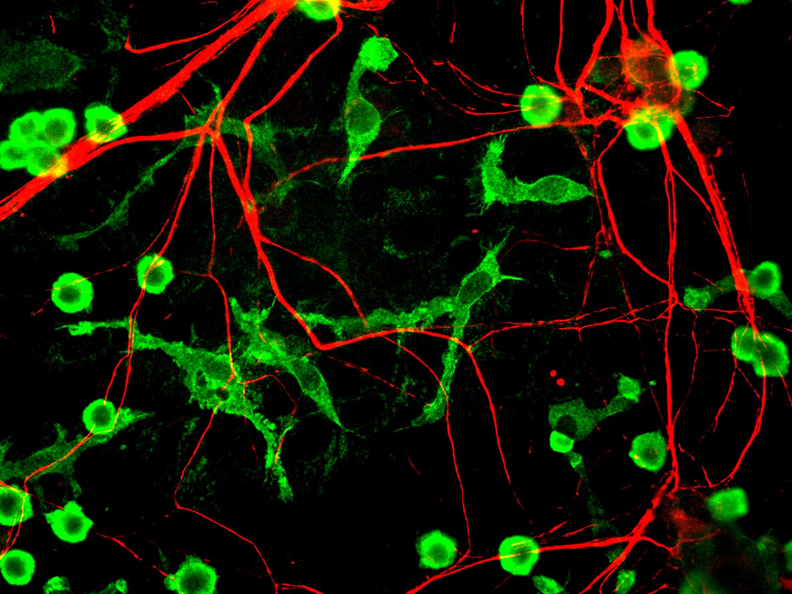 Microglia in green and neurons in red against a black background