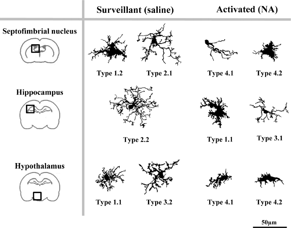 drawings of microglia in different shapes and sizes representing a proposed model of morphotypes